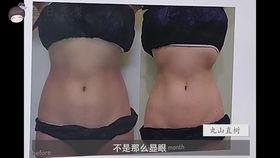 丰胸医生爆料视频播放,医生亲述手术内幕与风险 第3张 丰胸医生爆料视频播放,医生亲述手术内幕与风险 第3张